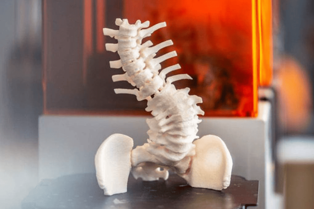 3D nyomtatás az orvosi prototípuskészítésben